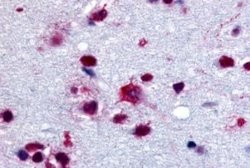 Glycogen Phosphorylase BB/GPBB Antibody, Novus Biologicals 50 &mu;g; Unconjugated:Antibodies,